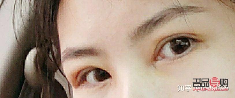 <h3>天生腫眼泡不手術(shù)，如何有效改善？</h3>