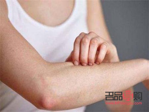 <h3>身體發(fā)癢怎么辦？有效護理方法大揭秘</h3>