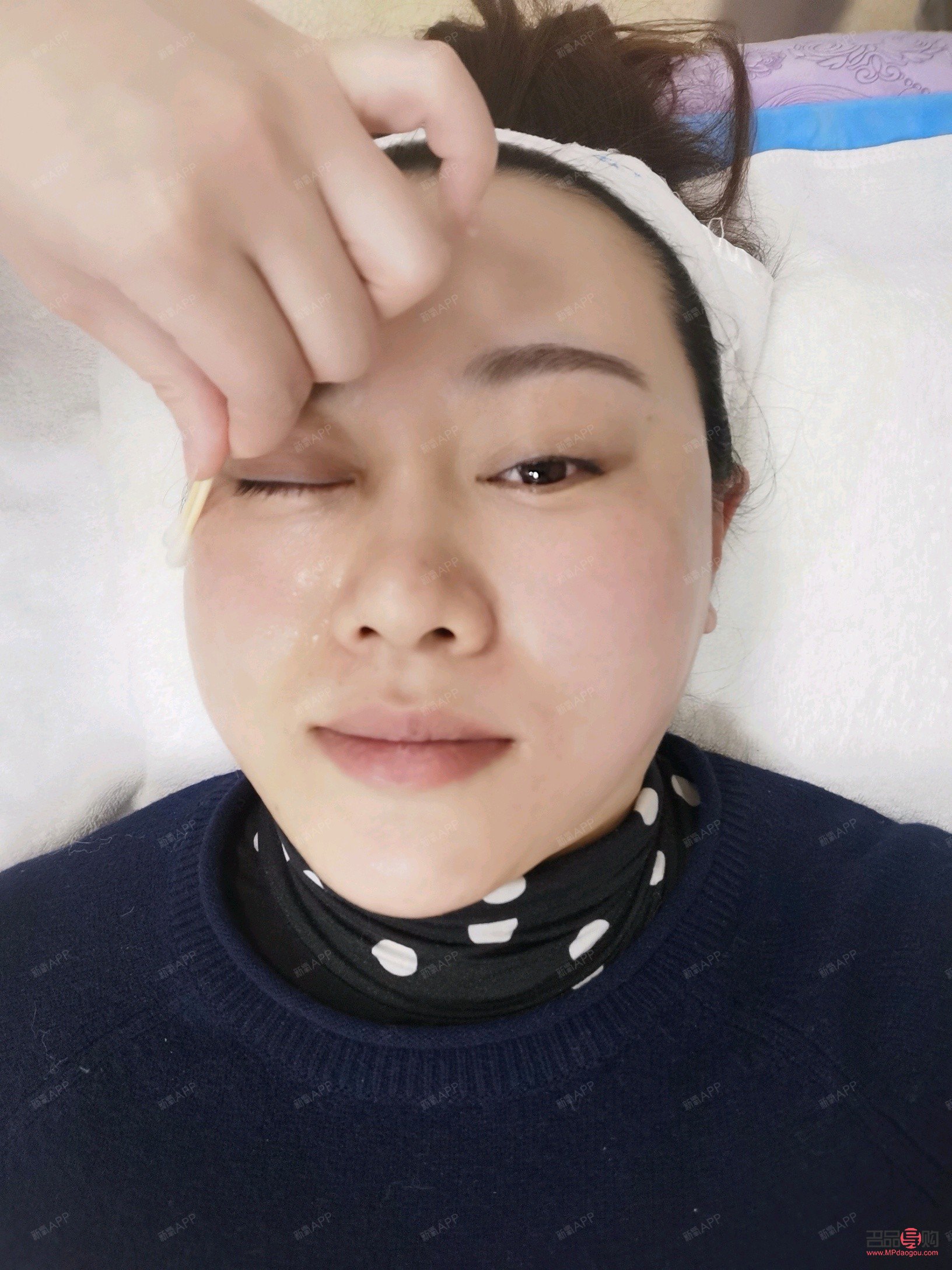 眼部熱拉提做后會腫嗎(眼部熱拉提做后會腫嗎)