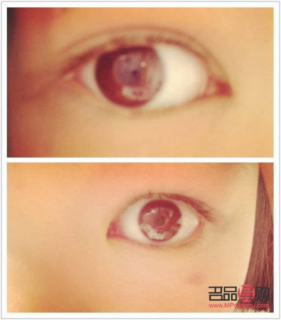 雙眼皮大小眼怎么調(diào)整圖片(雙眼皮大小眼怎么調(diào)整圖片大全)