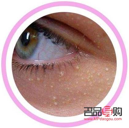 眼部衰老怎么修復(fù)最好(眼部衰老怎么修復(fù)最好的方法)