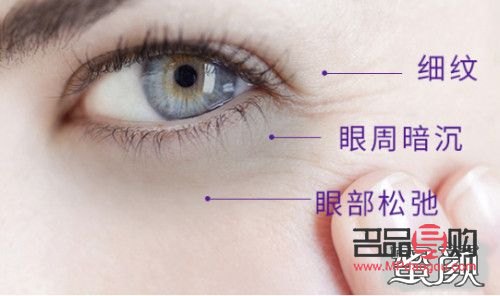 眼睛下面長皺紋，如何應(yīng)對？