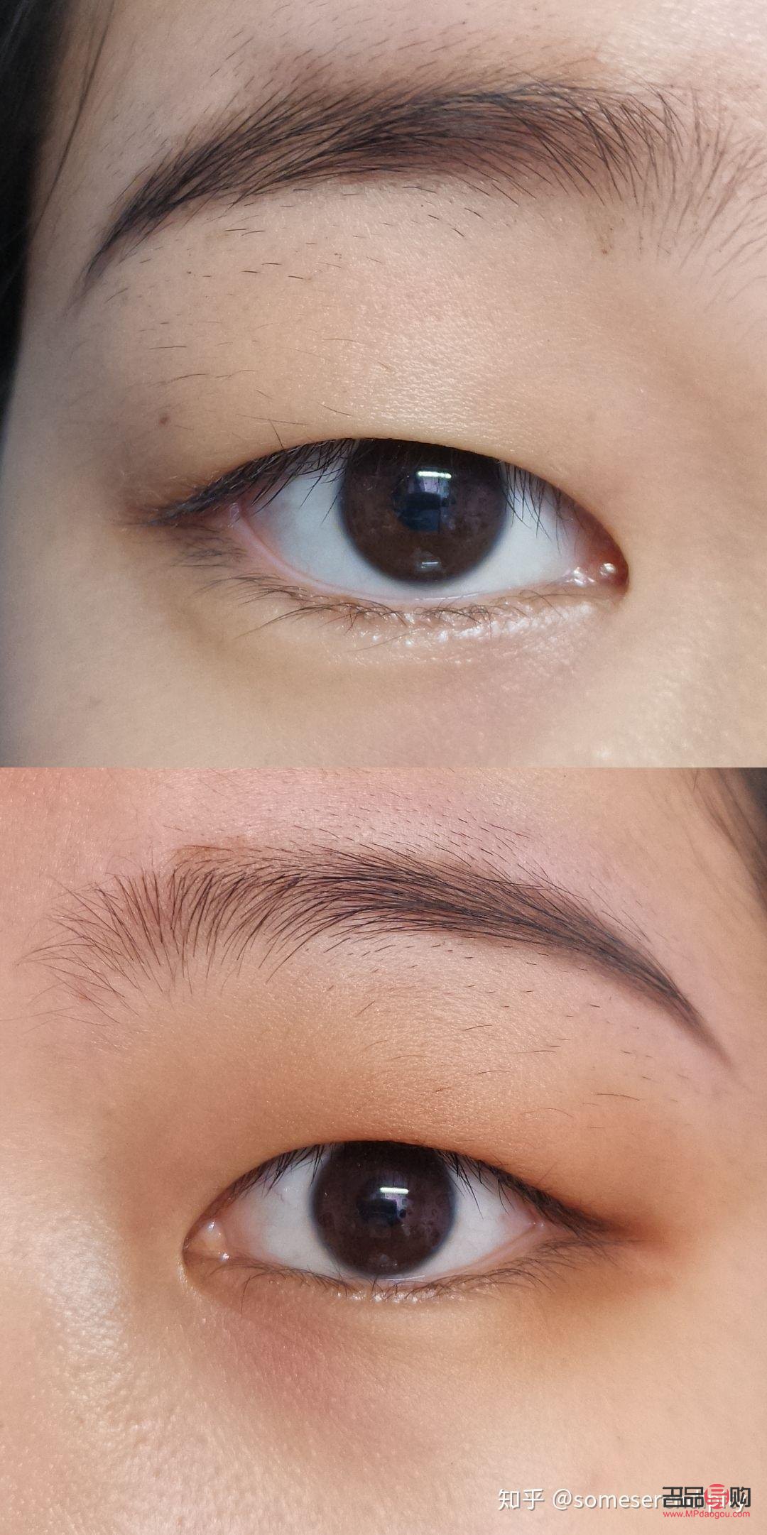 腫眼泡怎么改善(單眼皮腫眼泡怎么改善)