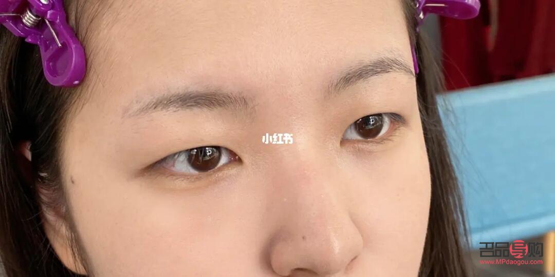 腫眼泡怎么改善(單眼皮腫眼泡怎么改善)