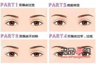 雙眼皮：寬與窄，哪一種更具魅力？