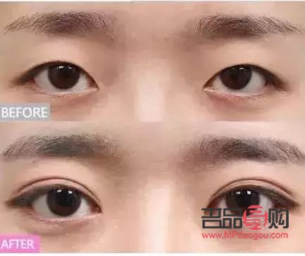 5種雙眼皮型(幾種雙眼皮的眼型)