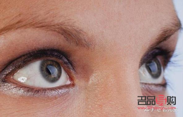 甲亢眼睛和正常人眼睛(眼球突出與正常眼圖片)