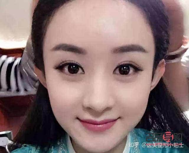 新月型雙眼皮真人圖片女孩(新月型雙眼皮真人圖片女孩可愛(ài))