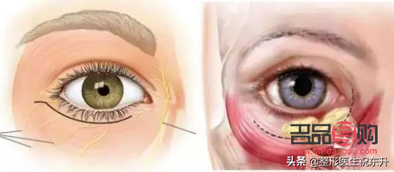 眼袋和淚溝一起做手術(shù)可以嗎(眼袋和淚溝一起做手術(shù)可以嗎多少錢)