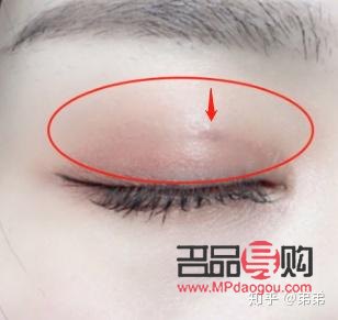 雙眼皮有三條線 是什么原因(雙眼皮有三條線 是什么原因造成的)