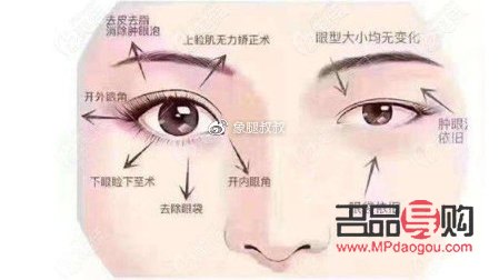 小眼綜合四項都包括什么(小眼綜合四項都包括什么內(nèi)容)