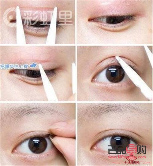 <h3>雙眼皮埋線：打造迷人電眼的秘密武器</h3>