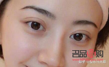 全切雙眼皮寬修窄(全切雙眼皮寬修窄還是窄)