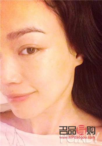 <h3>告別浮腫眼袋，重拾明亮雙眸</h3>