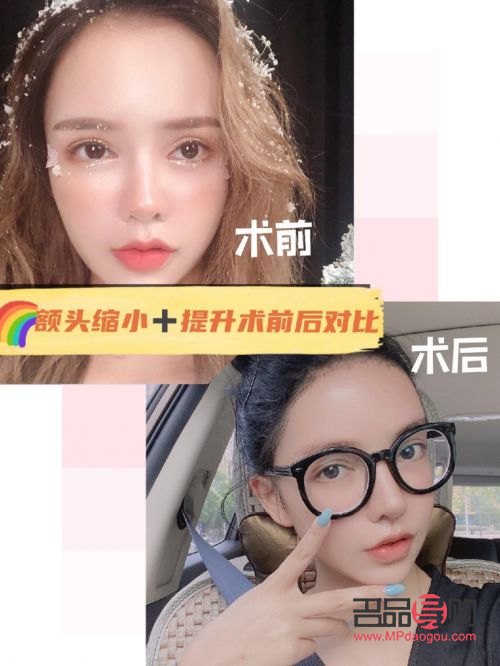 美容一管管用嗎(美容一次大概多少錢)