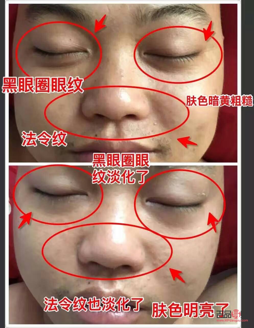 怎么針灸美容(怎么針灸美容養(yǎng)顏)