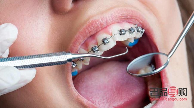 牙齒美容冠是什么(牙齒美容冠是什么意思)