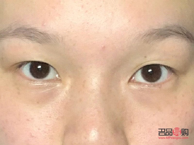 <h3>內(nèi)雙腫眼泡的消除秘訣</h3>