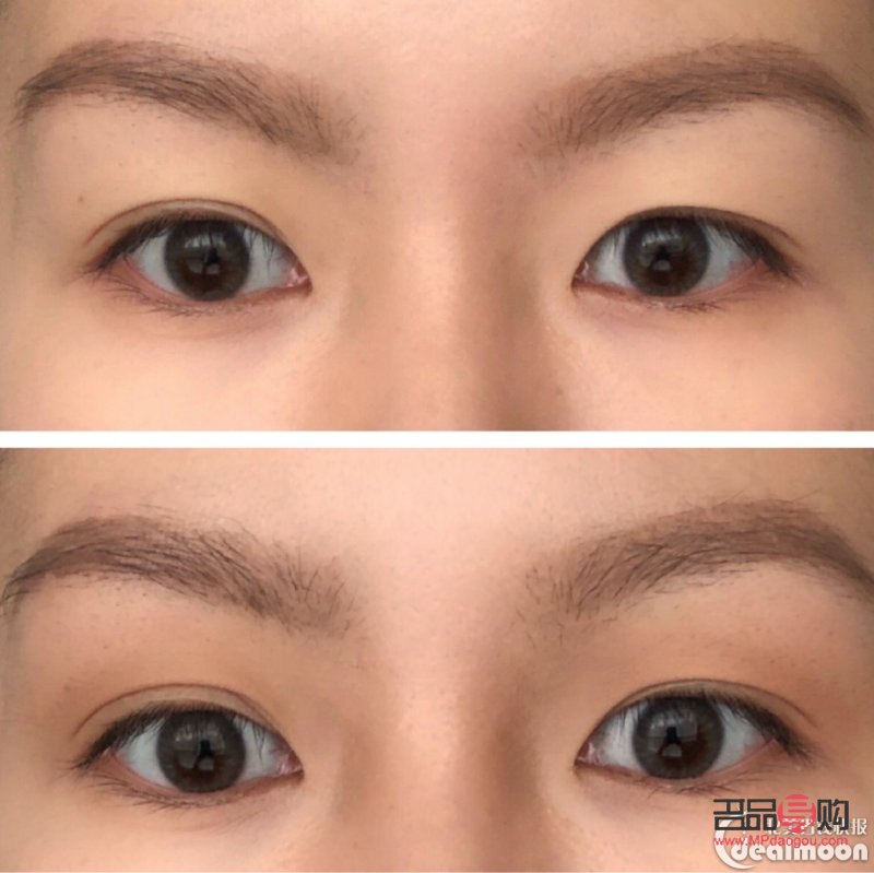 <h3>內(nèi)雙腫眼泡的消除秘訣</h3>