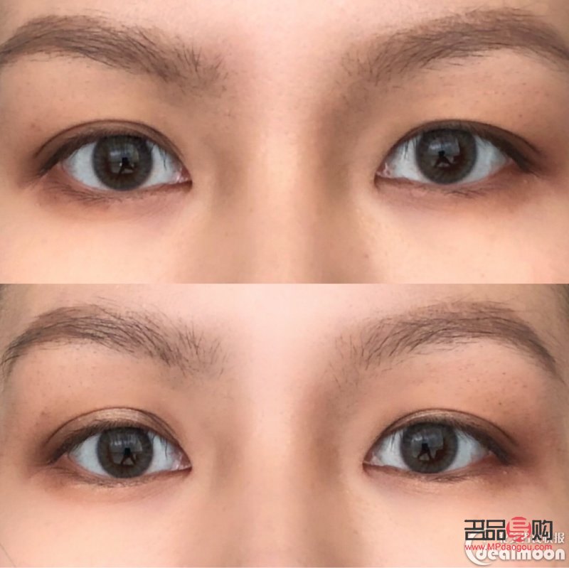 <h3>內(nèi)雙腫眼泡的消除秘訣</h3>