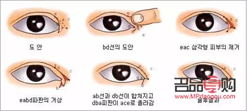 雙眼皮的魅力：探尋其在全球的分布與受歡迎程度