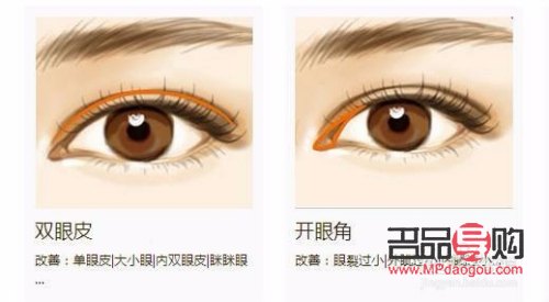 眼角下垂有什么辦法可以調(diào)整的(眼角下垂有什么辦法可以調(diào)整的小孩)