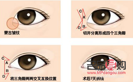 眼角下垂有什么辦法可以調整的(眼角下垂有什么辦法可以調整的小孩)