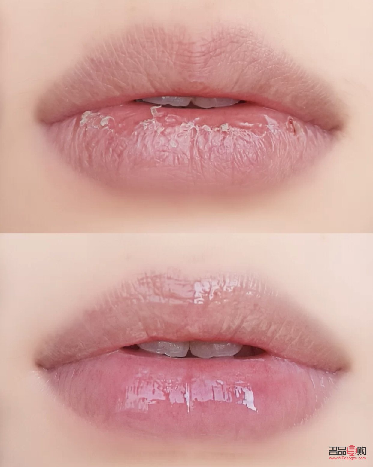 身體怎么護理能細嫩呢(身體怎么護理能細嫩呢女生)