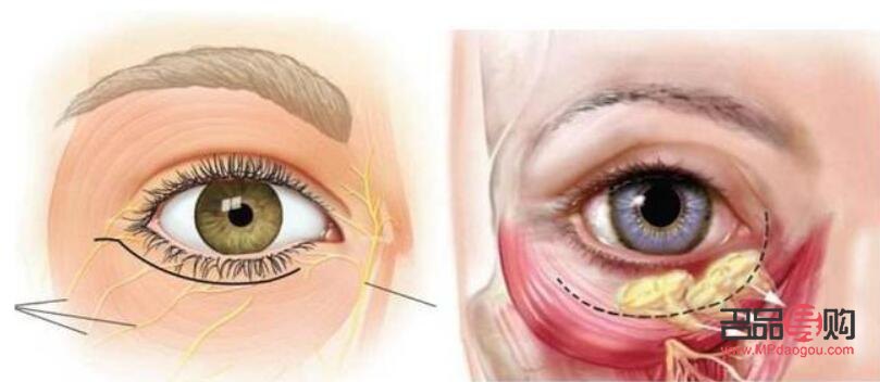內(nèi)切眼袋手術(shù)需要多長(zhǎng)時(shí)間(內(nèi)切眼袋手術(shù)需要多長(zhǎng)時(shí)間恢復(fù))