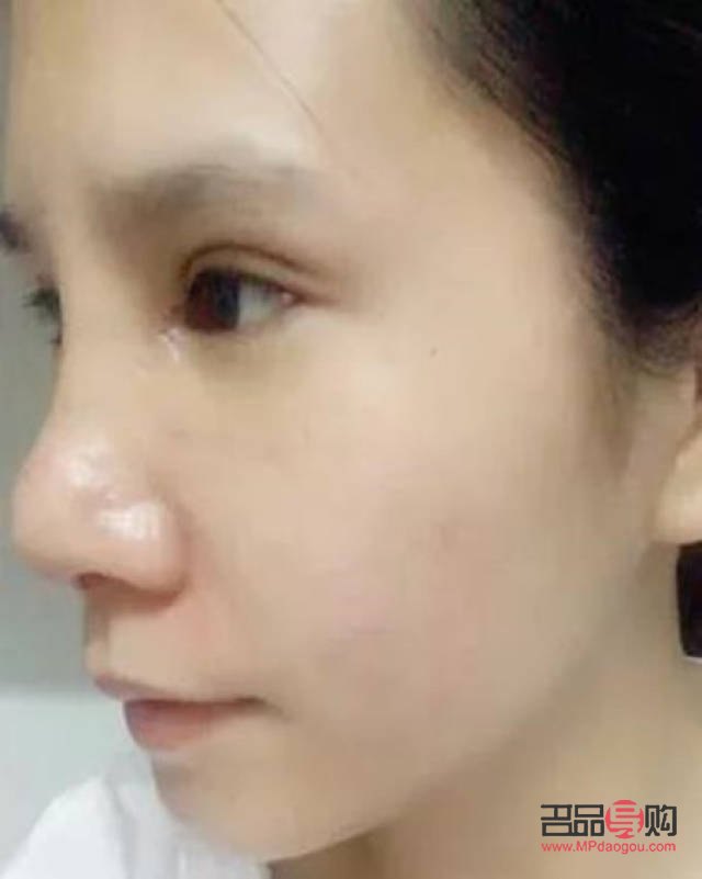 眼綜合跟全切有啥區(qū)別(眼綜合跟全切有什么區(qū)別)