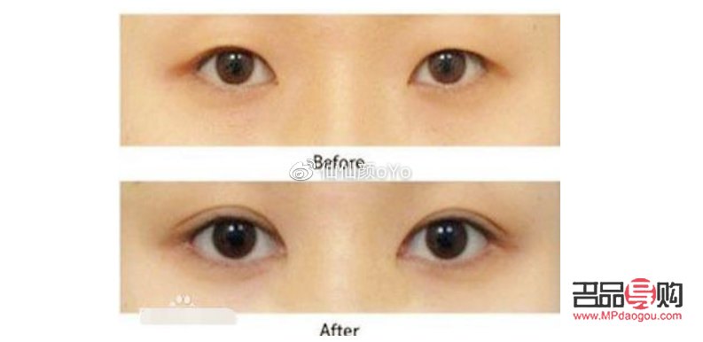 <h3>春秋兩季，雙眼皮成形的最佳時機</h3>