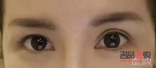 春秋兩季，雙眼皮成形的最佳時機