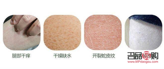 身體很干燥怎么護(hù)理(身體很干燥怎么護(hù)理好)