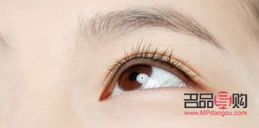 割雙眼皮手術(shù)后的恢復(fù)期需多久？