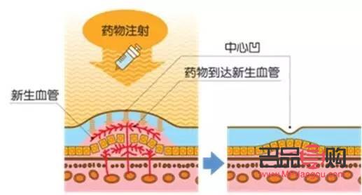 眼療的作用與功效的廣告語有哪些(眼療的作用與功效的廣告語有哪些呢)