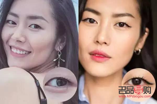 <h3>重塑青春明眸：眼皮松弛的恢復(fù)之道</h3>