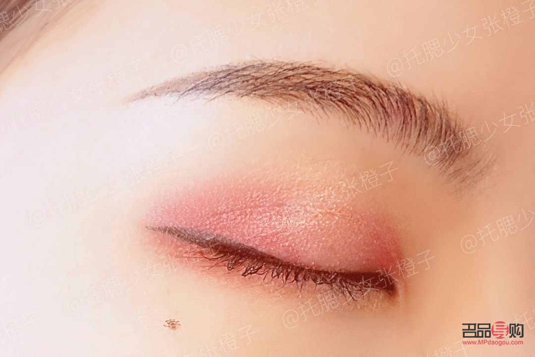 <h3>重塑青春明眸：眼皮松弛的恢復(fù)之道</h3>