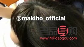 <h3>唇裂能否進行美容修復？</h3>