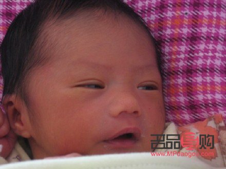 一單一雙眼皮可以割雙眼皮嗎(一單一雙可以做雙眼皮手術(shù)嗎)