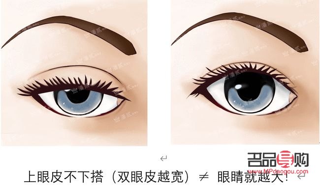 上眼皮松弛恢復(fù)鍛煉法(上眼皮松弛恢復(fù)鍛煉法圖片)