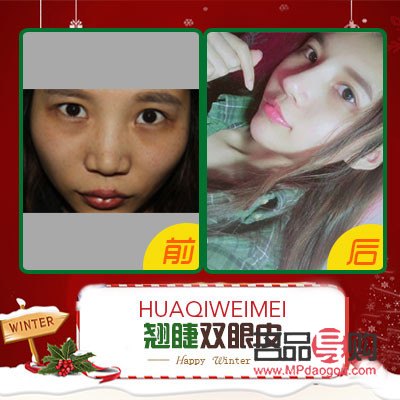 西安眼部整形醫(yī)生預(yù)約(西安眼部整形醫(yī)生預(yù)約掛號)