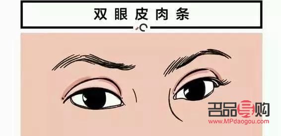 割雙眼皮和自然雙眼皮的區(qū)別圖片(割雙眼皮和自然雙眼皮的區(qū)別圖片大全)