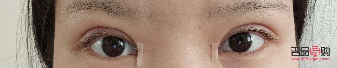 兩個眼皮不一樣怎么回事(兩個眼皮不一樣怎么回事兒)