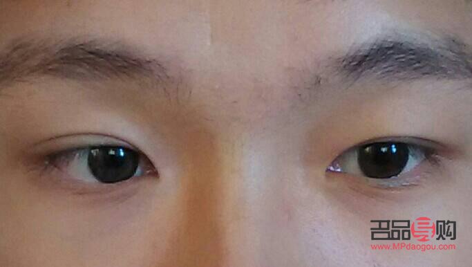 兩個眼皮不一樣怎么回事(兩個眼皮不一樣怎么回事兒)