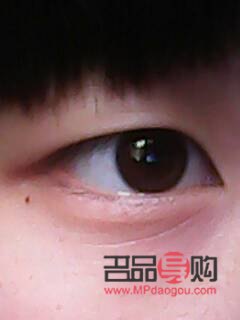 眼睛下方長皺紋了怎么辦(眼睛下方長皺紋了怎么辦呢)