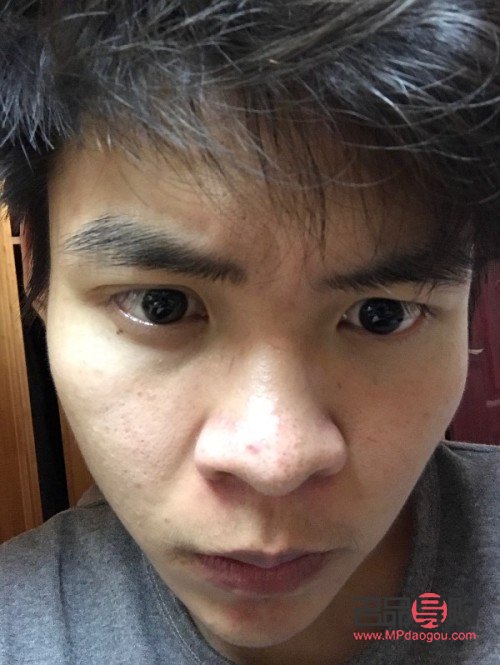 眼睛下方長皺紋了怎么辦(眼睛下方長皺紋了怎么辦呢)