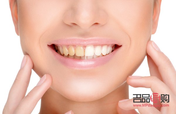 牙尖怎么美容的(牙尖怎么辦有什么小妙招)