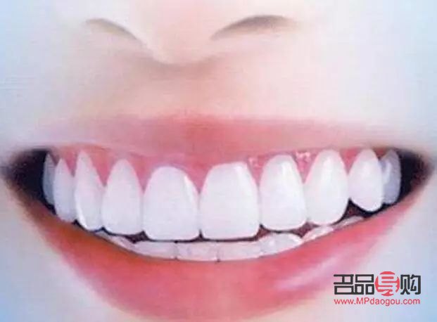 牙尖怎么美容的(牙尖怎么辦有什么小妙招)