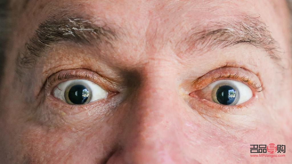 視神經(jīng)萎縮：一只眼睛幸免于難