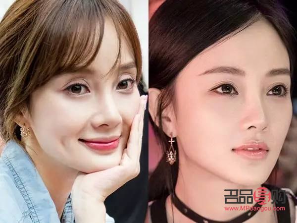 雙眼皮成功的案例有哪些(雙眼皮成功的案例有哪些)